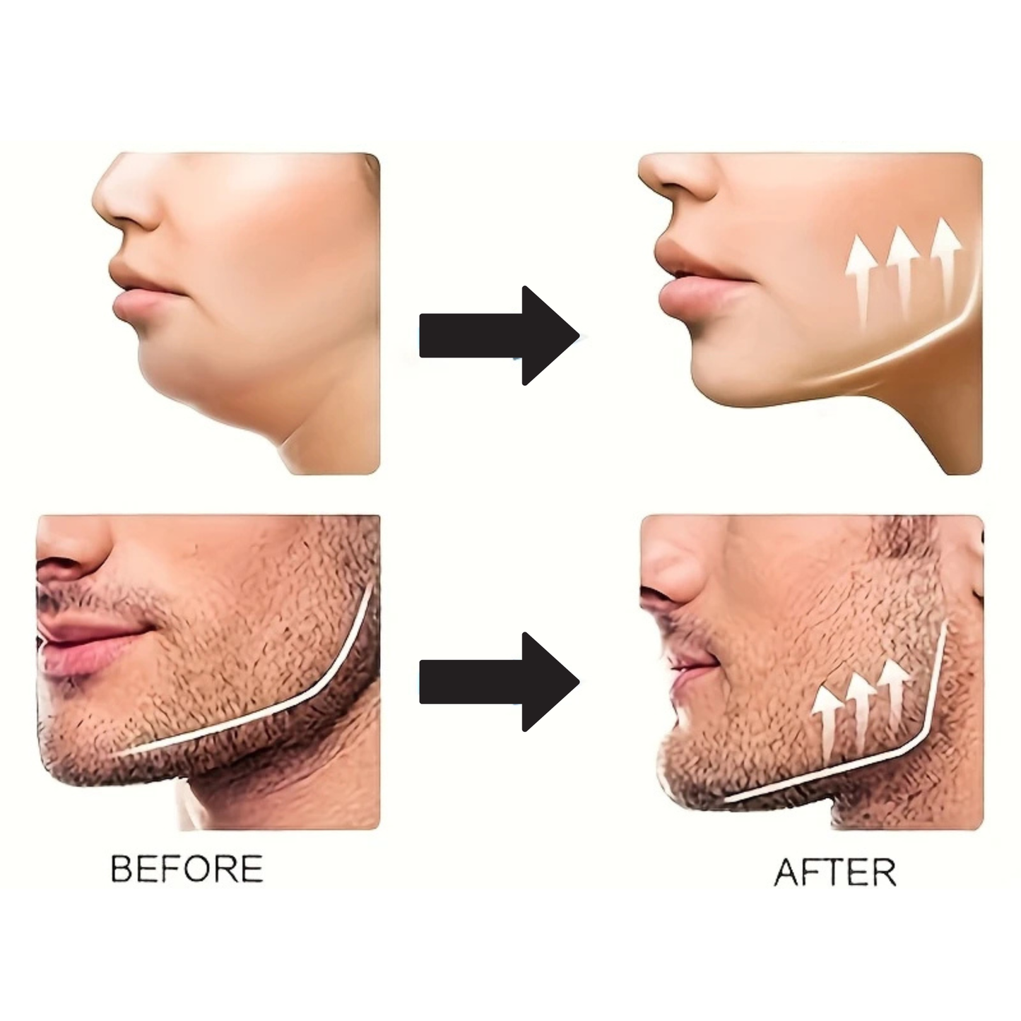 UJAWLINER jaw exerciser benefits infographic