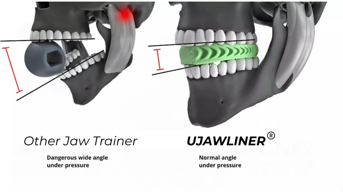 Why Training Method Matters: Molars vs. Front Teeth When Using a Jaw Exerciser